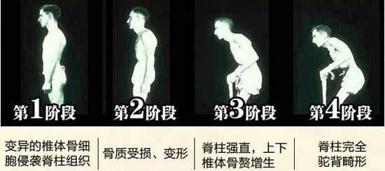 Fꖏ(qing)ֱt(y)Ժ(qing)ֱԼ׳ʹYҕ(hu)P(gun)(ji)׃Σ.jpg