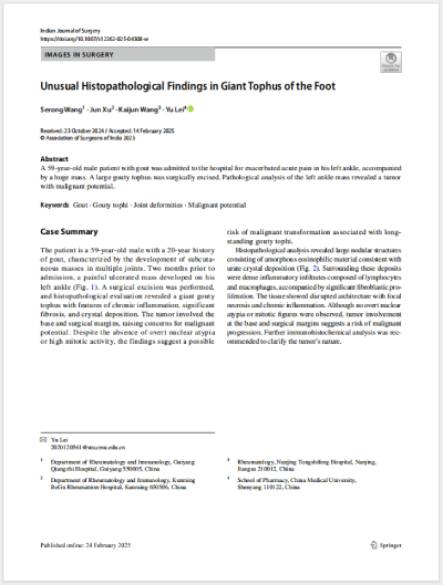 2025.2ɫεȹͬ׫¡Unusual Histopathological Findings in Giant Tophus of the Foot㲿޴ʹL(fng)ʯĮMW(xu)F(xin)SCIڿIndian Journal of Surgeryl(f).png